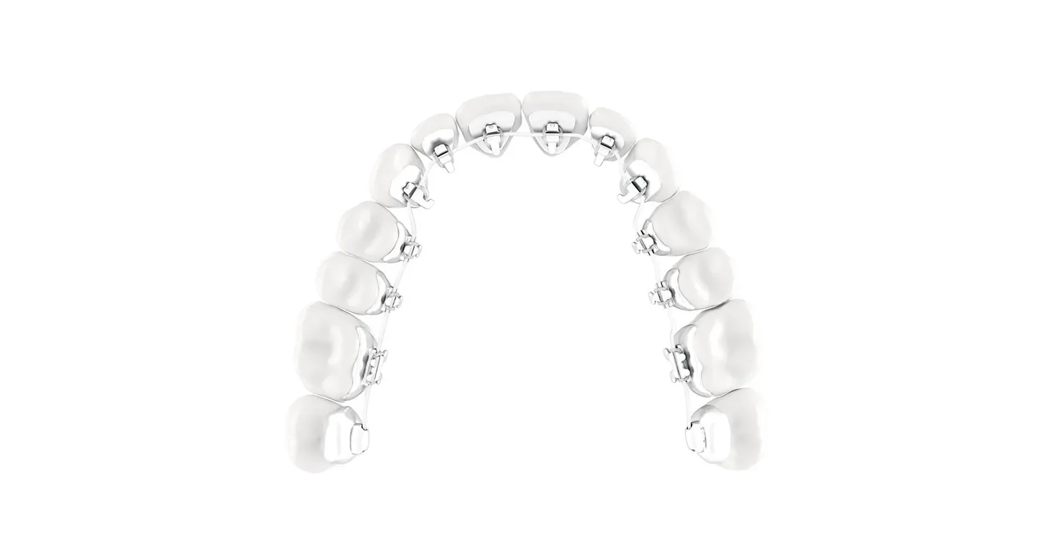 Durchsichtige innenliegende zahnspange