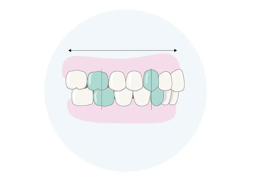 sagittale Zahnbeziehung