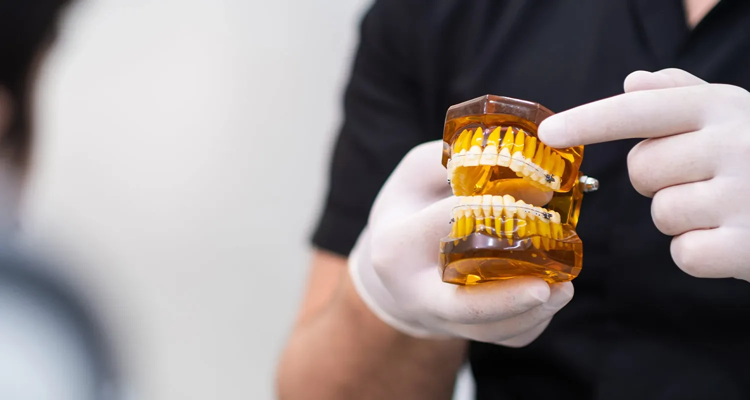 Zahntechniker hält eine Zahnspange in der Hand